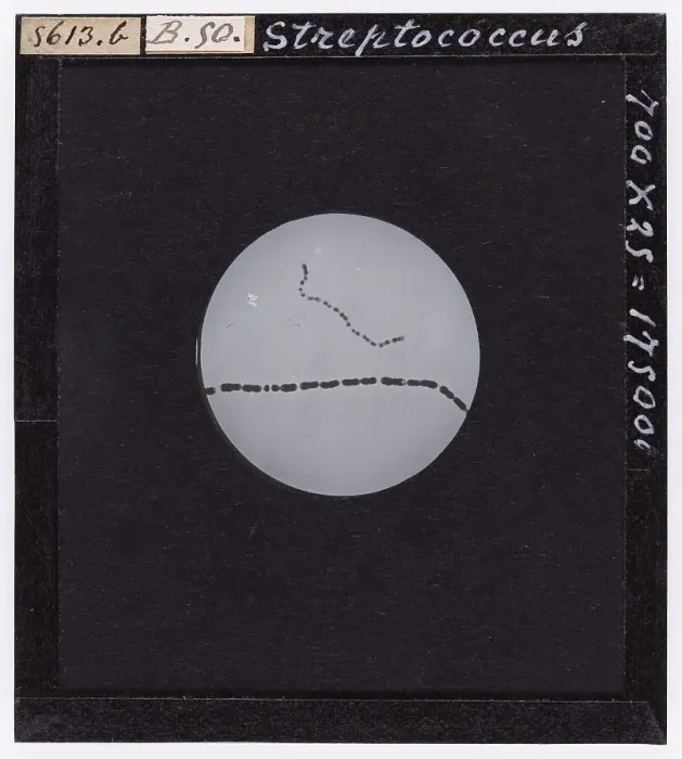Framed Print : Streptococcus: bacteria enlarged under a microscope Framed Print : Streptococcus: bacteria enlarged under a microscope