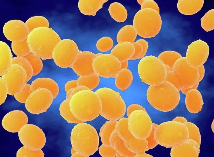Framed Print : MRSA Bacteria Print Framed Print : MRSA Bacteria Print