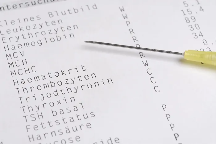 Framed Print : Blood Test Print: Laboratory Analysis Framed Print : Blood Test Print: Laboratory Analysis