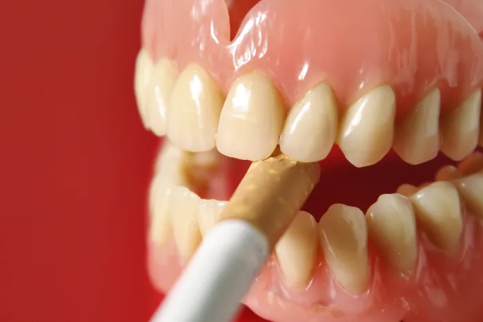 Framed Print : Artificial Dentures with Cigarette Print Framed Print : Artificial Dentures with Cigarette Print