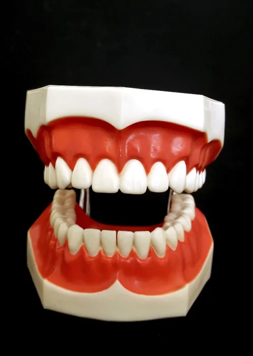 Framed Print : Denture Model Print Framed Print : Denture Model Print