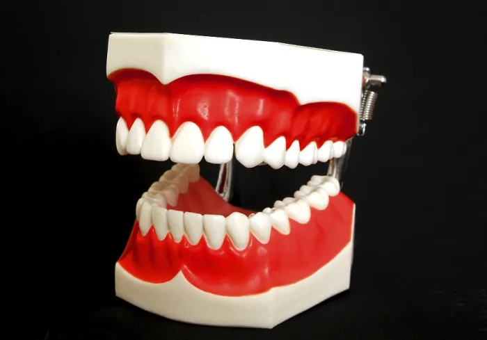 Framed Print : Denture Model Print Framed Print : Denture Model Print