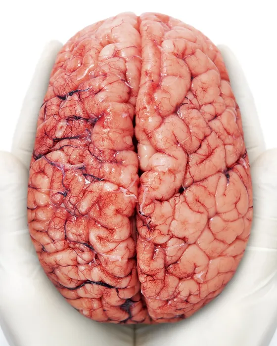 Framed Print : Human Brain Print - Anatomical Illustration Framed Print : Human Brain Print - Anatomical Illustration