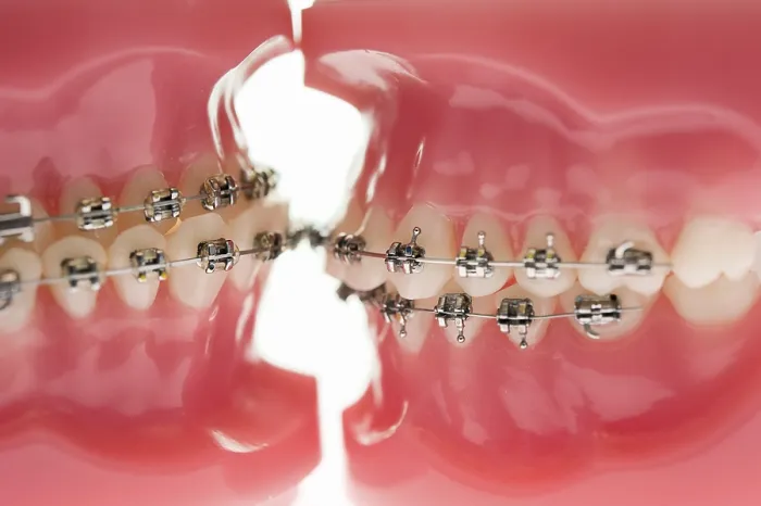 Framed Print : Two Teeth Models in Dentist's Office Print, Germany Framed Print : Two Teeth Models in Dentist's Office Print, Germany