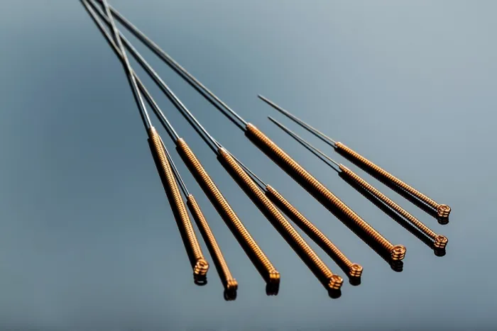 Framed Print : Acupuncture Needles Print Framed Print : Acupuncture Needles Print