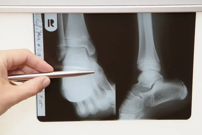 Framed Print : Radiograph Print, Medical Imaging Framed Print : Radiograph Print, Medical Imaging