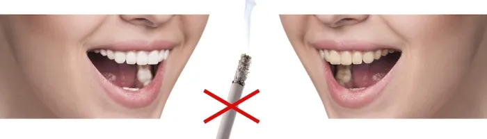 Framed Print : Smile Before and After Smoking Print Framed Print : Smile Before and After Smoking Print