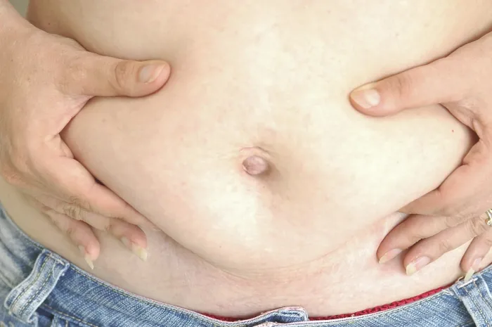 Framed Print : Thick Belly Print by ImageBROKER Framed Print : Thick Belly Print by ImageBROKER