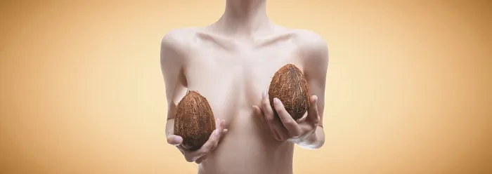 Framed Print : Woman with Coconuts and Silicone Implants Print Framed Print : Woman with Coconuts and Silicone Implants Print