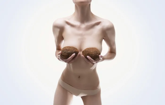 Framed Print : Woman with Coconuts and Silicone Implants Print Framed Print : Woman with Coconuts and Silicone Implants Print