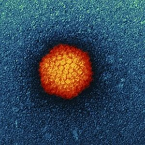 Adenovirus particle, TEM