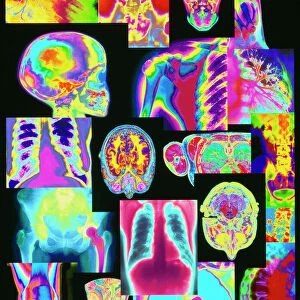 Assortment of coloured X-rays and body scans