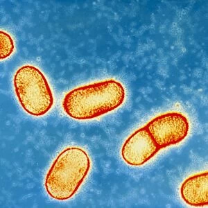 Bacteroides gingivalis bacteria