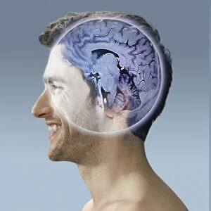 Brain scan, conceptual image C017 / 7398