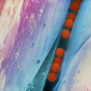 Coloured SEM of DNA security beads on a diamond