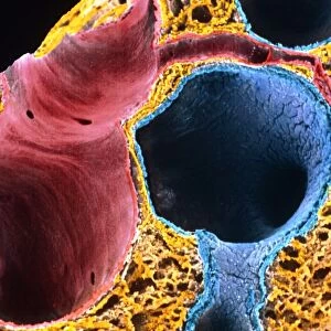 Coloured SEM of lung showing alveoli and bronchus