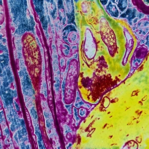 Coloured TEM of a nerve synapse