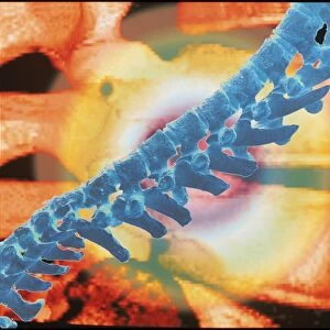 Computer artwork of a spine depicting back pain
