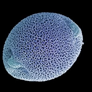 Dinoflagellate plankton, SEM