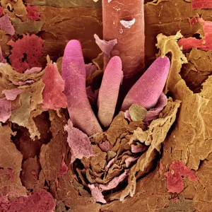 Eyelash mite tails, SEM