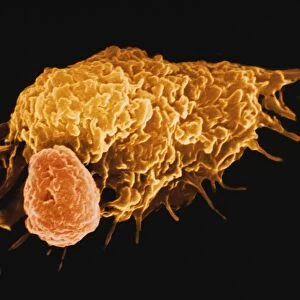 False-colour SEM of a macrophage & lymphocyte