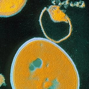 False-colour TEM of Staphylococcus aureus