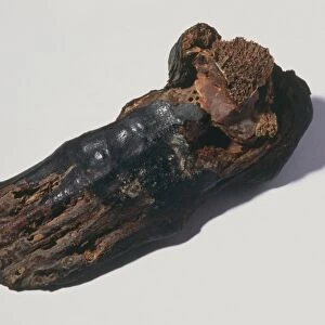 The foot of an Egyptian mummy