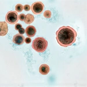 Hartmannella vermiformis protozoa cysts C016 / 9401