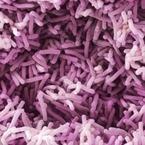 Lactobacillus casei shirota bacteria SEM