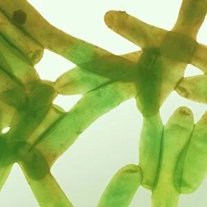 Legionella bacteria, light micrograph