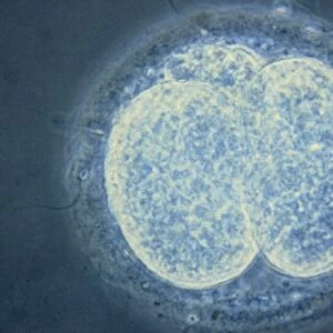 LM of human embryo at two-cell stage