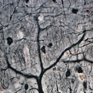 LM of a Purkinje cell in the cerebellum