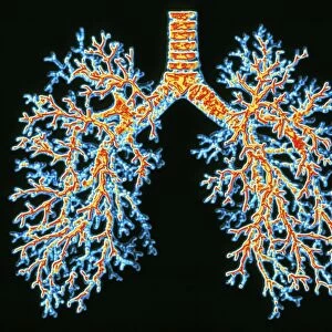 Lung airways