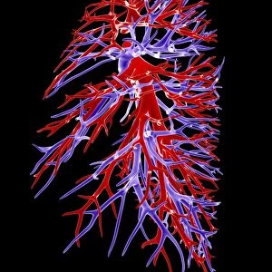 Lung blood vessel, artwork
