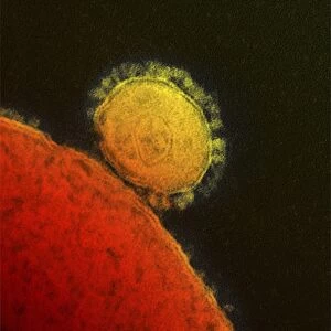 MERS coronavirus, TEM C017 / 8300