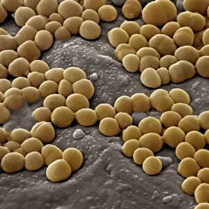 MRSA bacteria, SEM C018 / 0306