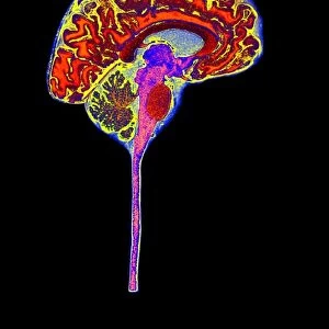 Normal human brain, MRI scan C016 / 8841