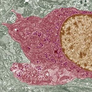 Thyroid parafollicular cell, TEM