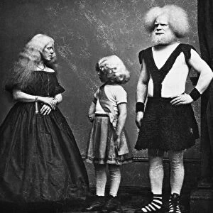 CIRCUS FREAKS, 1857. The Lucasie Family of Holland, exhibited in P