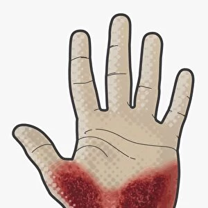 Digital illustration of bleeding wound on palm of hand