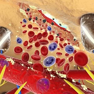 Digital cross section illustration wound below human skin showing red and white blood cells and yell