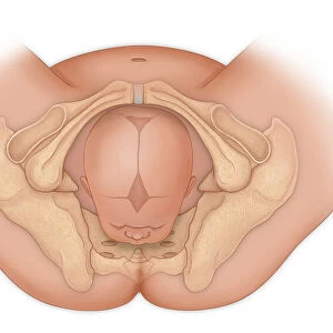 Doctors view of a baby in occipital anterior position ready for delivery