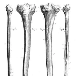Leg bones anatomy engraving 1866