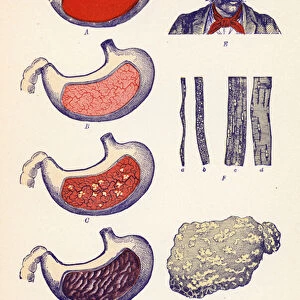 Effects of Alcohol and Tobacco (colour litho)
