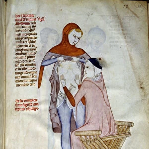 Surgery: Physician palpating a patient. Miniature in "Liber notabilium Philippi septimi francorum regis, a libris Galieni extractus"written by Gui (Guy) of Pavia, 1345, Italy. Dim: 32x22cm. Chantilly, Conde Museum