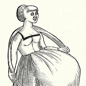 Woman said to have been pregnant for nine years (engraving)
