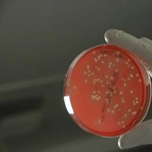 Bacteria from human skin grown on agar in the laboratory