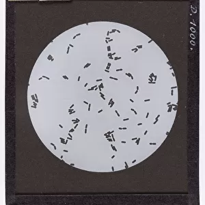 Bacillus Chauvaei, enlarged under a microscope