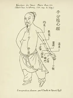 Alternative Healing Methods Prints: Acupuncture
