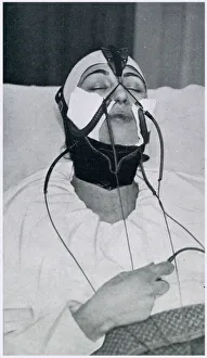 Apparatus for the Removal of the Double Chin 1927 Apparatus for the Removal of the Double Chin 1927